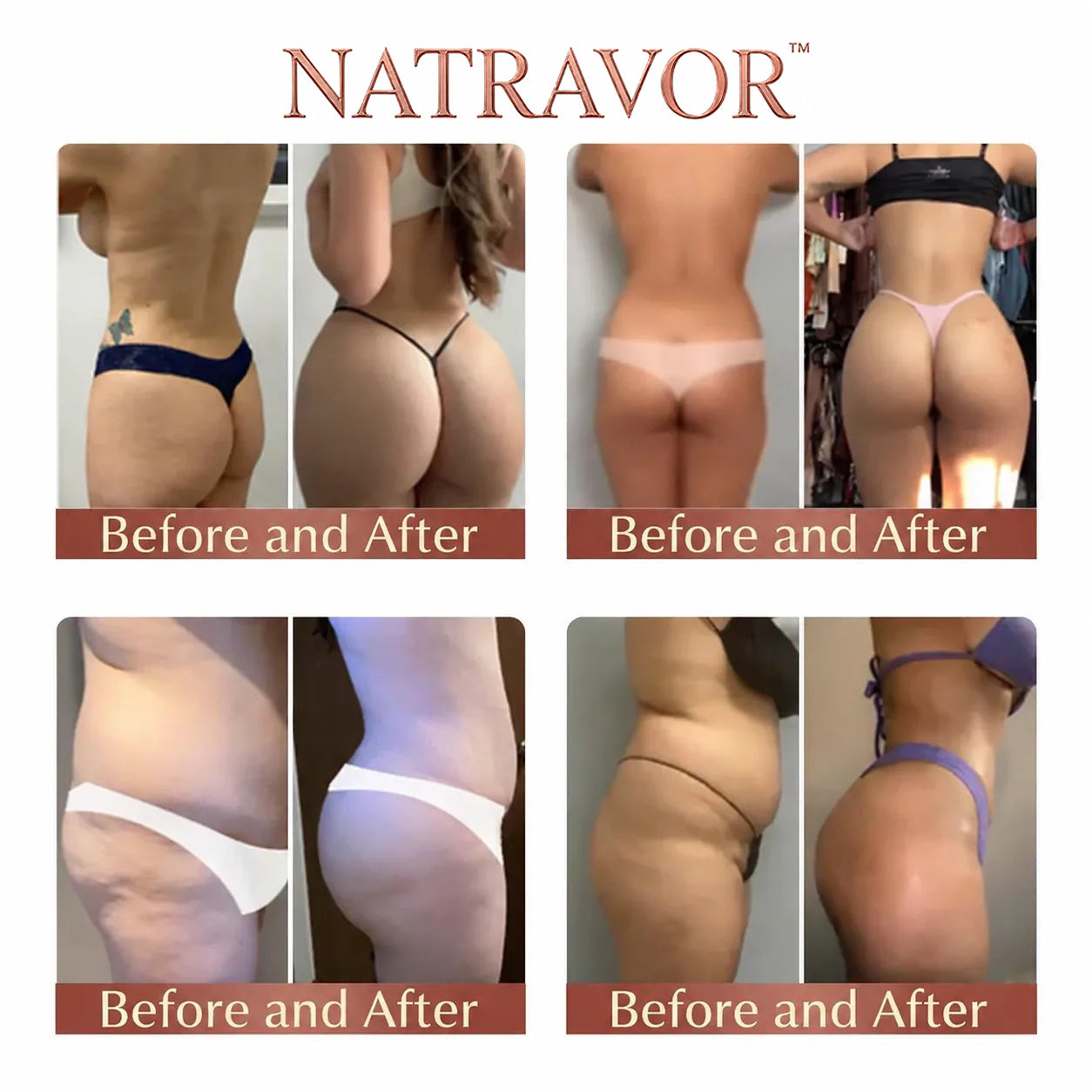 NATRAVOR™ CurveSculpt Micro-Patch ✦ Sculpt • Firm • Smooth Lower Body Curves ✦ Micro-Needle Infusion System