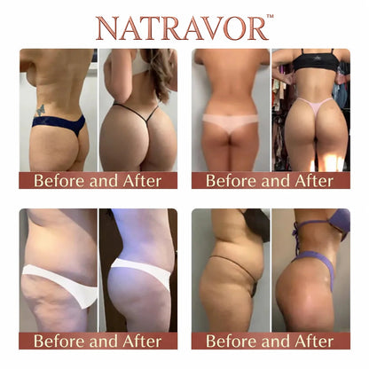 NATRAVOR™ CurveSculpt Micro-Patch ✦ Sculpt • Firm • Smooth Lower Body Curves ✦ Micro-Needle Infusion System
