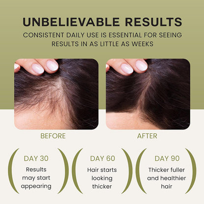 🌿Louxlue Oil for Hair Growth (BOGO) - 100% Pure, Raw & Natural Haircare Serum