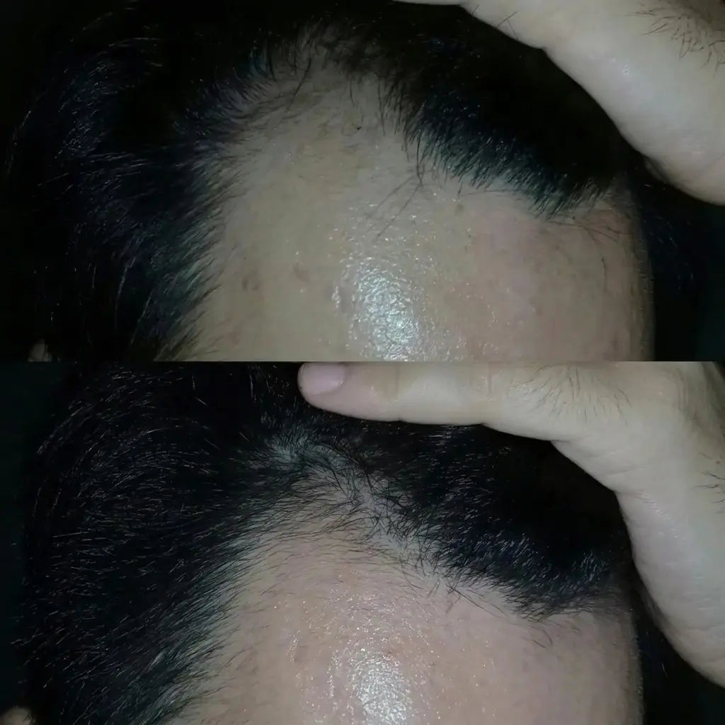 Deoxyribose Scalp Serum™