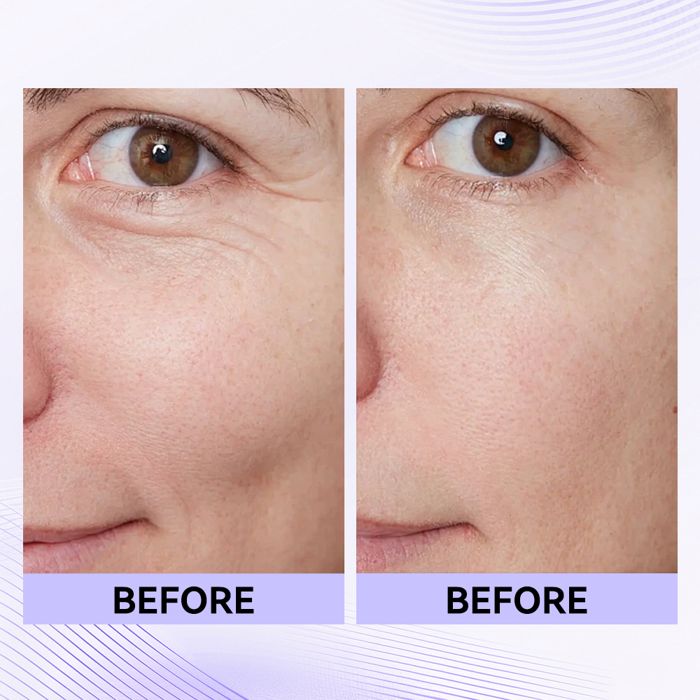 Last 3 Hours:🔥 Up to 15% OFF – Instant Eye Tightener Easy-Wear Formula