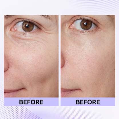 Last 3 Hours:🔥 Up to 15% OFF – Instant Eye Tightener Easy-Wear Formula