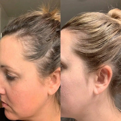 Deoxyribose Scalp Serum™