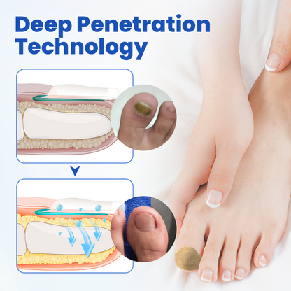 FungalPatch - Antibacterial Fungal Patch