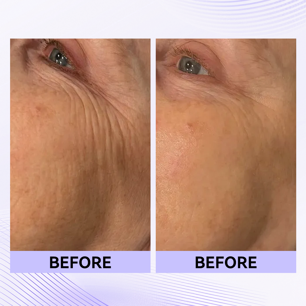 Last 3 Hours:🔥 Up to 15% OFF – Instant Eye Tightener Easy-Wear Formula