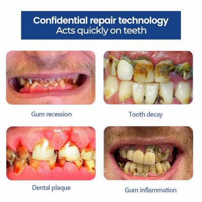Natravor™ Whitening Tooth Cleansing Powder 🦷Obtain American Dental Association (ADA) Certification (Treats periodontitis and mouth ulcers, prevents tooth loss, and repairs gum recession)
