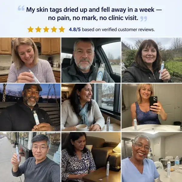 Erase Moles, Skin Tags & Spots in Just 7 Days